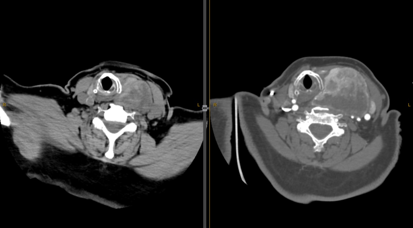 Thyroid ablation imaging